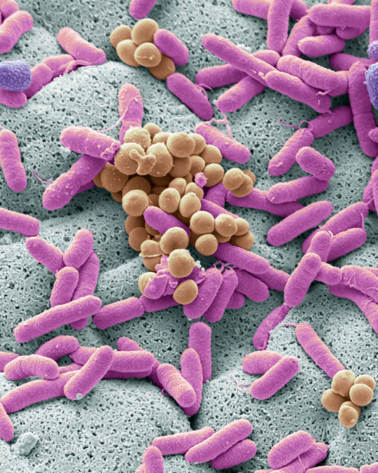 ¿Sabías qué al año se producen unos 600 millones de casos de infección por alimentos y unas 400000 muertes en todo el mundo?